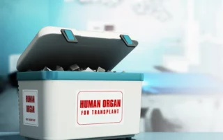 A container for transplant organs